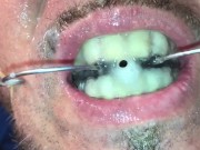 Piss and cum facial on my huge vanbeek braces
