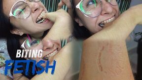 Biting fetish