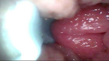 Extreme Proximity Turns Watcher Into Active, Hungry Participant