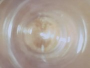 A deep look inside my ass - inside anal view - Straightdoesbi