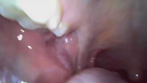 Vicky's Endoscopic Mouth Tour