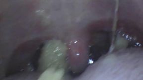 Marylin Endoscopic Mouth (Bagel Eating)