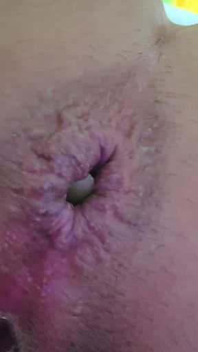 Close-up of a bottle inserted into the anus...
