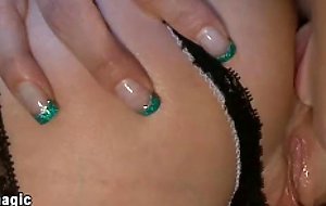 Three lesbians anal prolapse