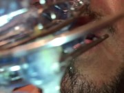 Self facial cumming on braces retainer twinblock with headgear