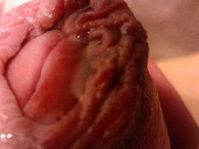 Marinated Foreskin Penis