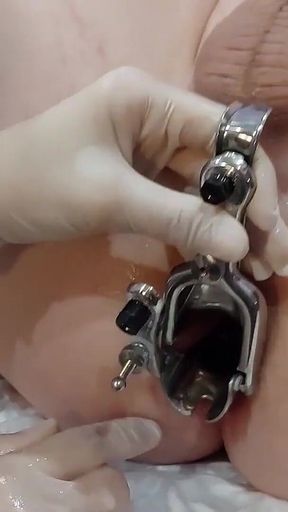 Analysis with a surprise from a nurse