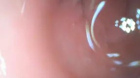 Anal endoscope