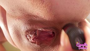 Request Video From Leo Ns and Great Close-ups