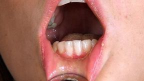 Mouth Tour With Teaspoon HD-720