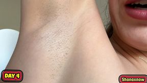 10 days armpits grow hair evolution video