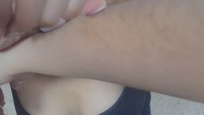 Natural Beauty on My Arms.