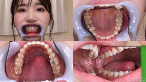 Ayaka - Watching Inside mouth of Japanese cute girl bite-243-1 - 1080p