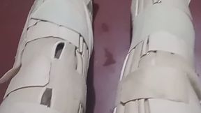 LEGS WITH ORTHOSES