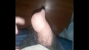 Fimosis verga peque&ntilde_a