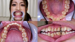 Minaho Ariga - Watching Inside mouth of Japanese cute girl - 1080p