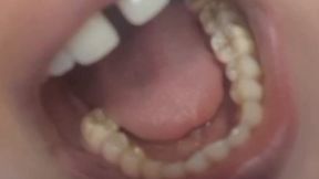Showing my ugly yellow teeth