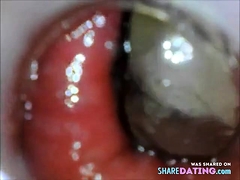 anal endoscope ass play from inside