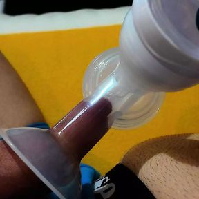 Trying out Breast Pump on my foreskin.