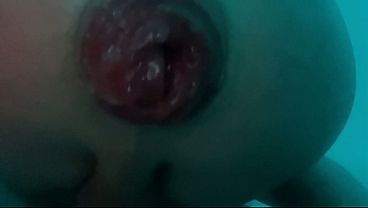 DickTaterish - Biggest Creampie rushing out of my Rosebud