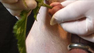 CBT - Nettles in my Pee Hole