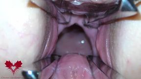 The Mistress Cunt Is Opened With A Hole Expander So That You Can Study Her Cervix