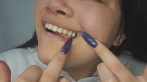 Deep examination of my entire mouth - wanna look?