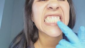 Close-ups of my teeth and mouth