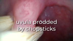 uvula prodded by chopsticks