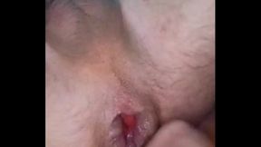 Swollen Ass After Intense Fisting Resembles Pussy In Sizzling Gay Scene