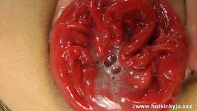 Hotkinkyjo's Extreme Anal Prolapse Session