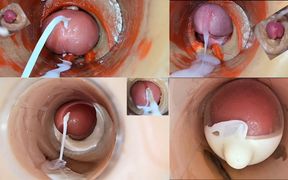 Cumfeti Dripping Creampie Compilation- Endoscopy View