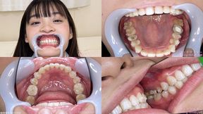 Urara - Watching Inside mouth of Japanese cute girl bite-264-1 - MOV