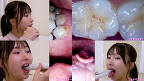 Kana Yura - Observing Kana's teeth, mouth, and back of the throat with a dental camera