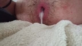 My gaped asshole after my XXL Buttplug