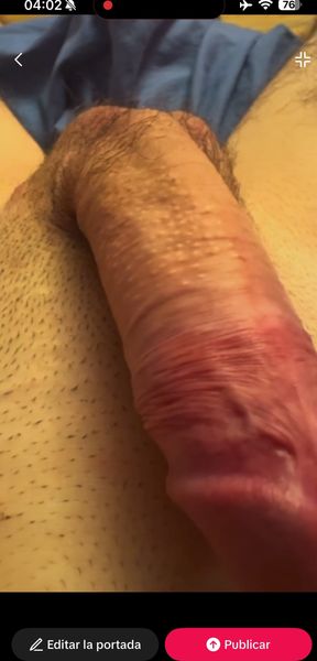 Masturbation