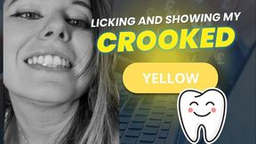 Crooked yellow teeth