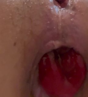 Anal Ripping, Rectal Propulsion