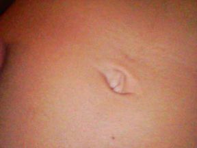 BELLY BUTTON: ENDOSCOPE | Donna