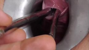 Amateur FreyjaAnalslut:  Multiple Sounds - James is stretching Freyja'_s urethra with multiple sounds - peeing into Freyja'_s gaping cunt