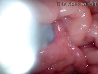 1st time: An endoscope discloses the G-spot up close – out of mounting!