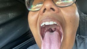 Sick swollen mouth tour