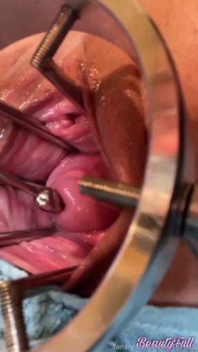 Exploring My Cervix With Sound And Fingers