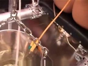 Bladder filling through catheter