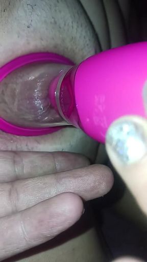 Tounge Sucker