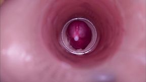 Female Insemination - Internal Camera Captures Deep Male Ejaculation