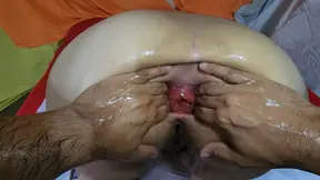 Double anal fisting &mdash;  anal fucking and anal prolapse after being pissed on my face by my man and drinking his piss