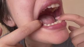 Fresh Missing Tooth & Dancing Uvula: Extreme Mouth Close-Up