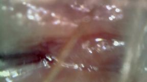 loud microscope farts inside my asshole 1080hd