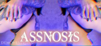 ASSNOSIS